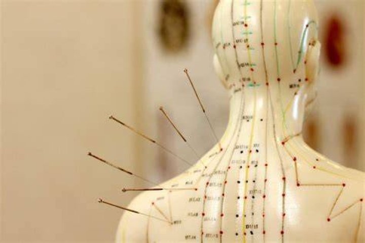 How much do Acupuncture make a year?